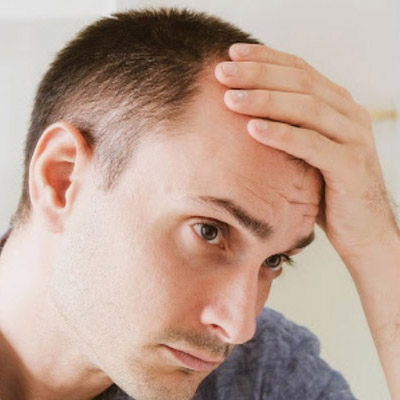 How to Stop Male Pattern Baldness?