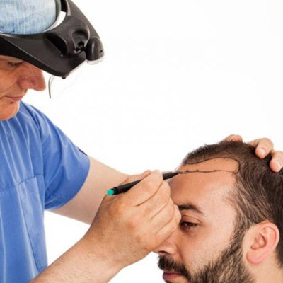 How Long Does It Take To See Results From Any Hair Loss Treatment