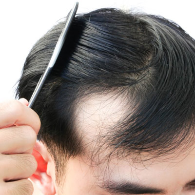 Is Hair Regrowth Really Possible