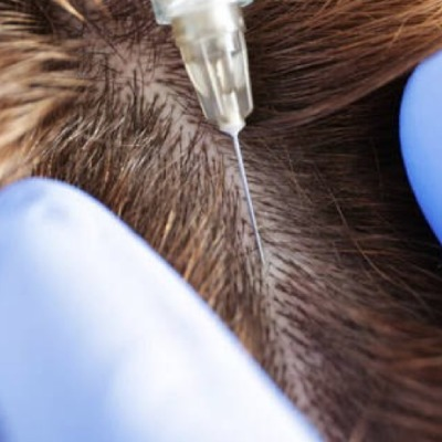 Top 10 Tips to Boost Your Hair Regrowth