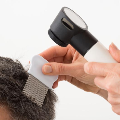 What Is the Most Effective Treatment for Hair Loss?