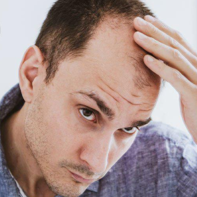 Know The Reason Why Does Diabetes Make You Bald?