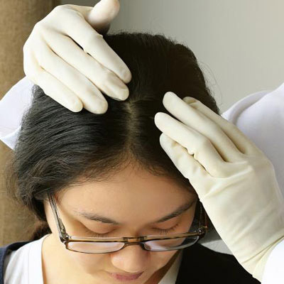 Hair Weaving in Ahmedabad: know Which clinic is best for Hair Weaving