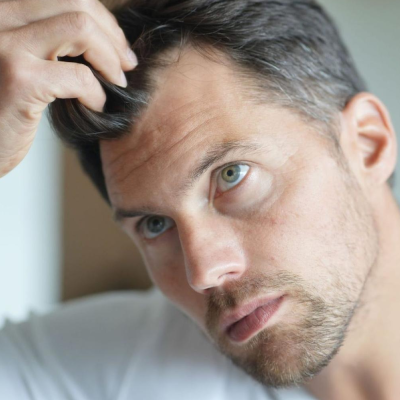 Losing Hair? Get The Best Consultation From Indias Leading Brand