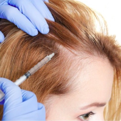 Female Hair Transplant: Can Women Opt for Surgical Hair Restoration?