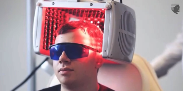 Laser Treatment for Hair Loss