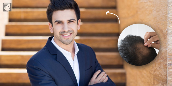 Hair Treatments that Work Wonders for Hair Loss