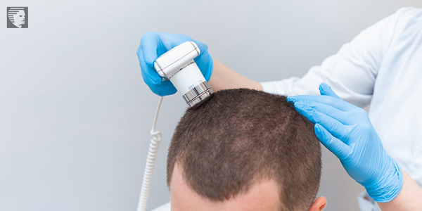 Hair Care Steps To Follow After Undergoing Hair Restoration Treatment