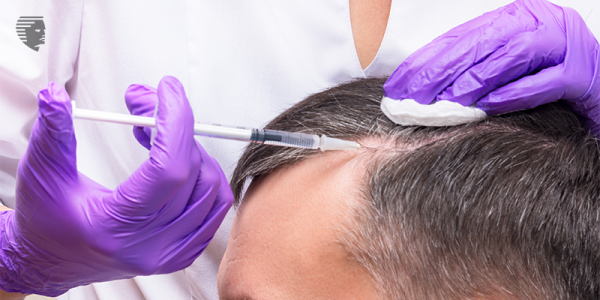 Treatments for Hair Loss - A Miracle or a Money Scam?!
