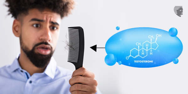 Is Testosterone the Cause of Your Hair Loss?