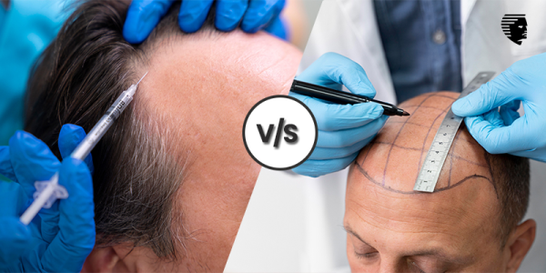 Hair Loss Medication Vs. Hair Transplant: Which is Right for You?