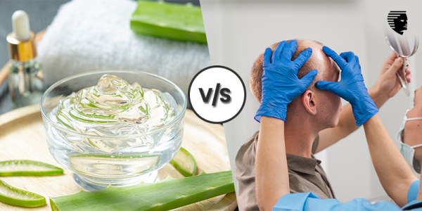 Home Remedies Vs. Hair Loss Treatment: A Comparison Guide