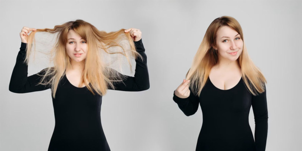 Seasonal Hair Shedding vs. Permanent Hair Loss