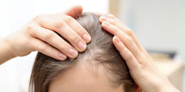 How Estrogen Affects Hair Loss: What You Need to Know