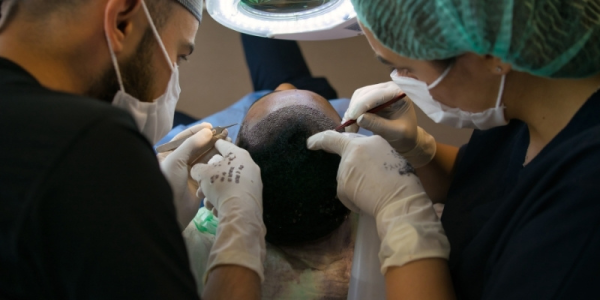 The Benefits of Global Hair Transplant Clinics