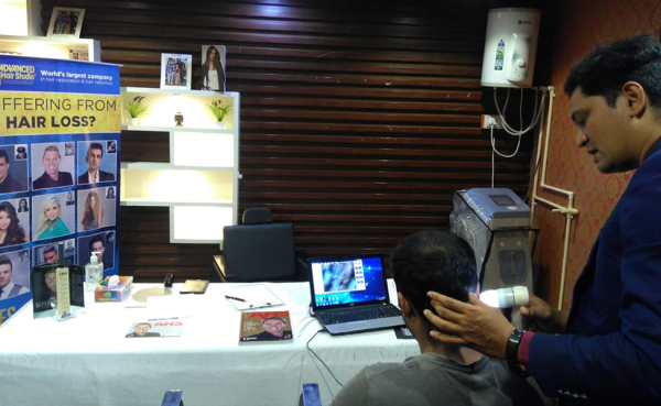 Hair Clinic in Vadodara | Hair Wellness Camp at Yep Salon
